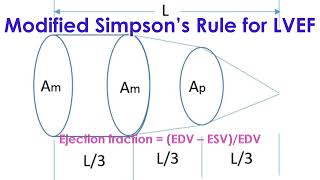 Modified Simpson’s rule for Left Ventricular Ejection Fraction [upl. by Renner]