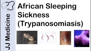 African Sleeping Sickness Trypanosomiasis  Causes Symptoms and Treatment [upl. by Ecirtap]