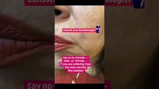 Dry patches on face  eyelids  skin peeling  Hot humid summer Dr Ashima Goel MD PARISA skin [upl. by Nomrah]