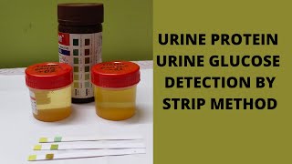 URINE ALBUMIN AND URINE GLUCOSE TEST PROCEDURE BI PARAMETER STRIP METHOD MLTPRACTICAL [upl. by Atalee]