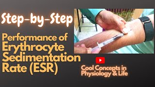 Master how to perform Erythrocyte Sedimentation Rate ESR 1st Prof MBBS English Urdu Hindi [upl. by Retse]