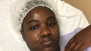 TTC JOURNEY  FIBROIDS REMOVAL SURGERY LUPRON INJECTION [upl. by Nonrev512]