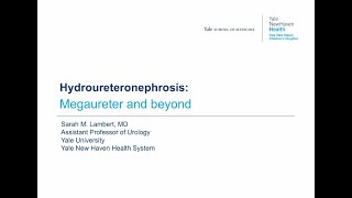 5282020 Urology COViD Didactics  Hydroureteronephrosis Megaureter and Beyond [upl. by Hanoj417]