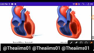 Myocarditis Heart diseases MNS topic for NORCET preparation Bsc nursing Gnm ANM competitive exams [upl. by Laved]