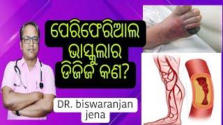 what is peripheral vascular disease କାରଣ ଲକ୍ଷଣ ଓ ଚିକିତ୍ସା ll Explained by DR Biswaranjan jena [upl. by Nabila]