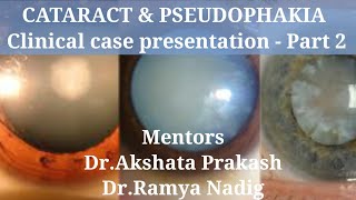 CATARACT amp PSEUDOPHAKIA Clinical case presentation  Part 2 [upl. by Artema]