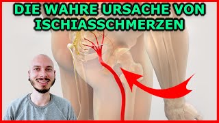 Die WAHRE Ursache von ISCHIASSCHMERZEN IschiasSyndrom  Wenn das Fundament wackelt [upl. by Coco543]