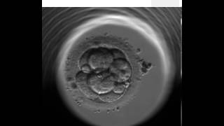 ES  continual monitoring of embryo development in Embryoscope [upl. by Ellertal]