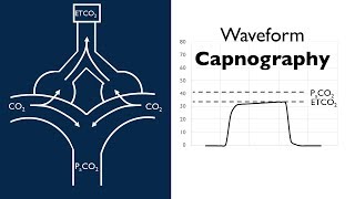 Waveform Capnography  BAVLS [upl. by Atisusej185]