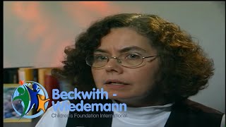 Speech and Feeding Issues In BeckwithWiedemann Children [upl. by Enilkcaj401]