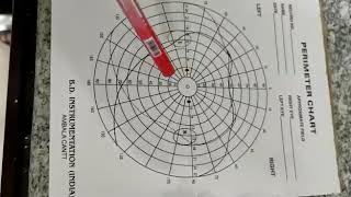 Perimetry 2 the perimeter chart [upl. by Acnairb347]