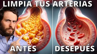 Haz Esto para Destapar tus Arterias y Corregir tu Colesterol [upl. by Perusse]