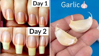 How to Grow Nails in 2 Days  How to Grow Nails Fast  jyoticachauhan [upl. by Onailerua]