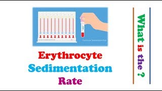 Hematology  Erythrocyte Sedimentation Rate ESR [upl. by Rolandson]