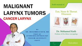 Malignant laryngeal tumors Cancer larynx Professor Dr Qotb [upl. by Adaline]