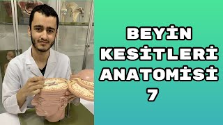 Beyin Kesitleri Anatomisi 7 [upl. by Niccolo]