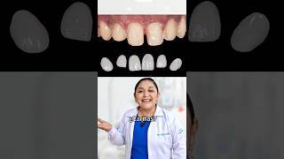 ¿Quieres Carillas Dentales dental odontologia sonrisa smile fyp greenscreen shorts [upl. by Pomfret]