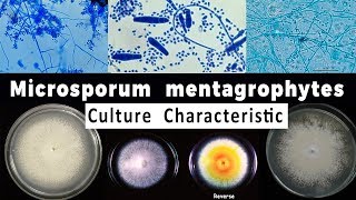 Trichophyton mentagrophytes culture Characteristic [upl. by Sucramat]