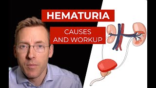 Hematuria causes and evaluation of blood in your urine [upl. by Natasha]