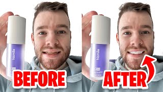 HiSmile v34 Colour Corrector  Get White Teeth Easy  Honest Review [upl. by Akimas]