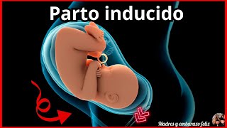 PARTO INDUCIDO  Como Parir  PASO A PASO Contracciones y mas [upl. by Socram415]