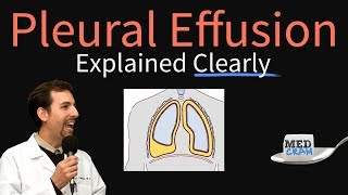 What is a pleural effusion  Respiratory system diseases  NCLEXRN  Khan Academy [upl. by Anaiek]