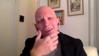 Anthony Carrigan Alopecia Bullying Awareness [upl. by Ajad713]