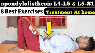 spondylolisthesis l5 s1 exercises spondylolisthesis l5 s1 grade 1 anterolisthesis l4 L5 treatment [upl. by Fortunia]