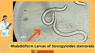 Understanding Strongyloides Rhabditiform Larvae A Comprehensive Guide  Parasitology [upl. by Oletta]