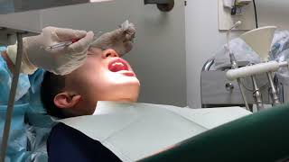 13 Year Old Visit To The Dentist For Dental Check Up Part 1 of 2 [upl. by Nivalc]