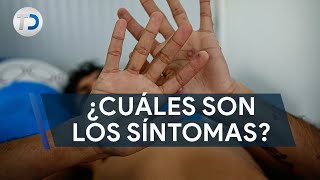 ¿Cuáles son los síntomas de la viruela del mono Estos son los casos en México [upl. by Enitselec]