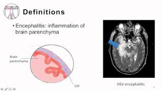 2 Bacterial Meningitis Pathogenesis and Clinical Manifestion [upl. by Cohn941]