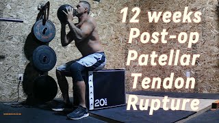 12 week update Patellar Tendon Rupture [upl. by Niggem]