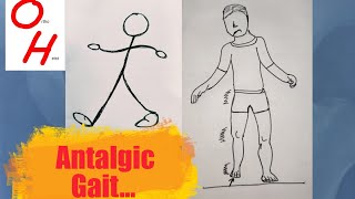 Antalgic gait [upl. by Htidirrem]