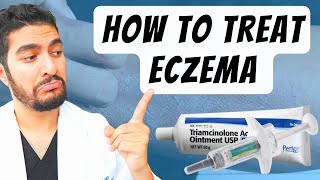 How To Treat Eczema Dermatologist Explains [upl. by Melton915]