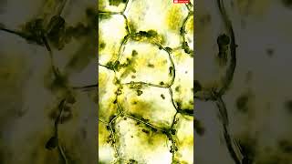 Movement of molecules in plant cell is viewed under a microscope osmotic pressurediffusionplant [upl. by Ennagrom]