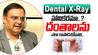 Advantage Of Dental XRay  Dental Treatment  Teeth Protection  Helthtips  Dhatri Health [upl. by Sutniuq297]