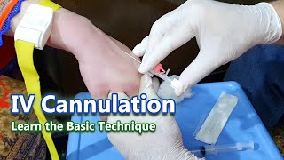 IV Cannulation  Learn the Basic Technique  IV Cannula [upl. by Sallyanne]