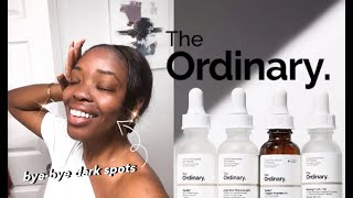 The Ordinary  5 BEST Products for Hyperpigmentation Dark Spots Oily  AcneProne Skin 2020 [upl. by Dafodil52]