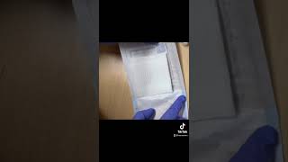 Wound Care using Iodosorb gel [upl. by Hsan768]