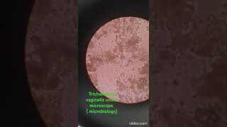 Trichomonas Vaginalis under microscope Microbiology [upl. by Nivlen688]