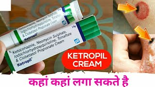 Ketoconazole Neomycin Iodochlorhydroxyquinoline Tolnaftate amp Clobetasol Propionate Cream Ketropil [upl. by Candless]