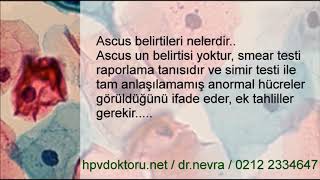 ASCUS nedir ASCUS Tanı ve Tedavisi ASCUS HPV 16 18 ASCUS Kolposkopi Sonuçları [upl. by Katharyn]