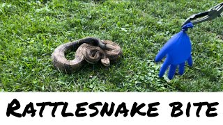 Rattlesnake Bite  Slow Motion Footage [upl. by Rovelli]