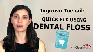 Ingrown Toenail A Quick Fix With Dental Floss [upl. by Kensell]