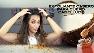 ✨ EXFOLIANTE CASERO PARA EL CUERO CABELLUDO✨⎸Adriana Motwani [upl. by Peursem]