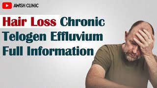 Chronic Telogen Effluvium  Hair Loss Ep4  By Dr Vijay Kumar in Hindi [upl. by Alba387]