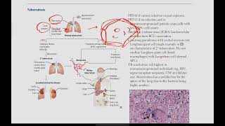 Mycobacteria Tuberculosis Leprosy  Microbiology  14  First Aid USMLE in UrduHindi [upl. by Lennor146]