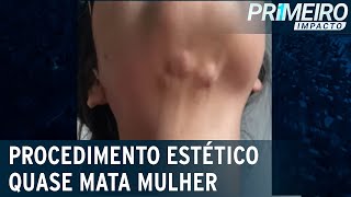 Influencer quase morre após procedimento estético  Primeiro Impacto 290822 [upl. by Alleuol32]