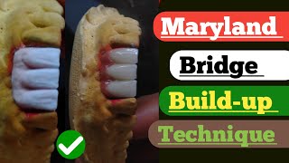 Maryland Bridge Build up techniques with pink ceramic Ceramic Build up video dental Technician [upl. by Babcock]